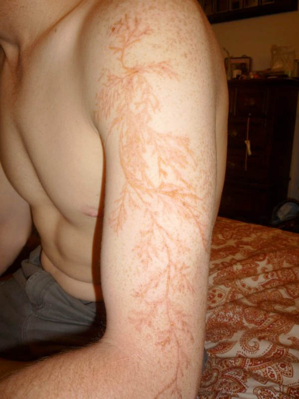 Lichtenberg_figure-4.jpg